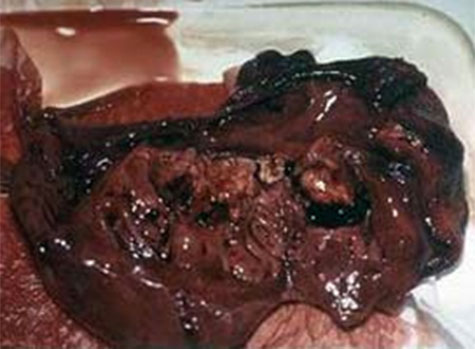 erisipelas y las valvulas en el corazon de cerdo