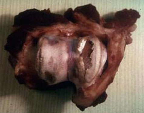 osteoartritis en cerdos y erisipela,el sitio porcino