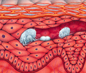 sarna-en-ganado-porcino