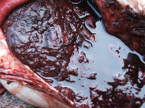 Estomago repleto de sangre digerida