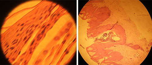 IMAGE NAME/DESCRIPTION Paraqueratosis-en-cerdos--el-sitio-porcino